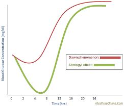 Diabetes: Somogyi effect vs dawn phenomenon - Food & Wellness