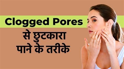 Clogged Pores Home Remedies: Get rid of clogged pores, follow these ...