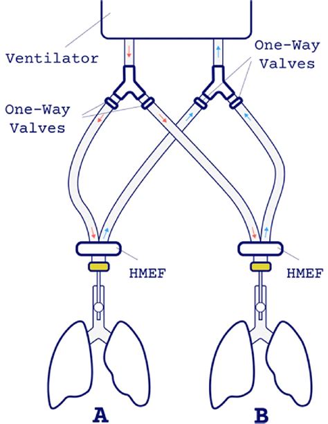 Determining volume, plateau pressure and PEEP in two test lungs without... | Download Scientific ...