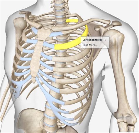 What happens to an untreated dislocated rib? - Dislocated Rib