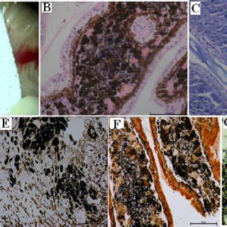 Cell culture and immunohistochemical staining of malignant melanoma... | Download Scientific Diagram