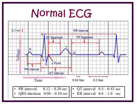 KNOWN UNKNOWN WORLD: It's very important to know all of you regarding to ECG