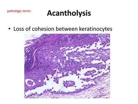 PPT - Skin Pathology PowerPoint Presentation - ID:1942011