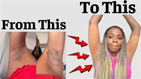 I Lightened My Dark UnderArms W These 3 SIMPLE STEPS | Shaving Tips 101 ...