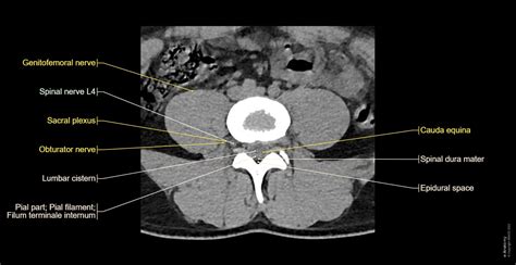 lumbar spine: normal anatomy | e-Anatomy