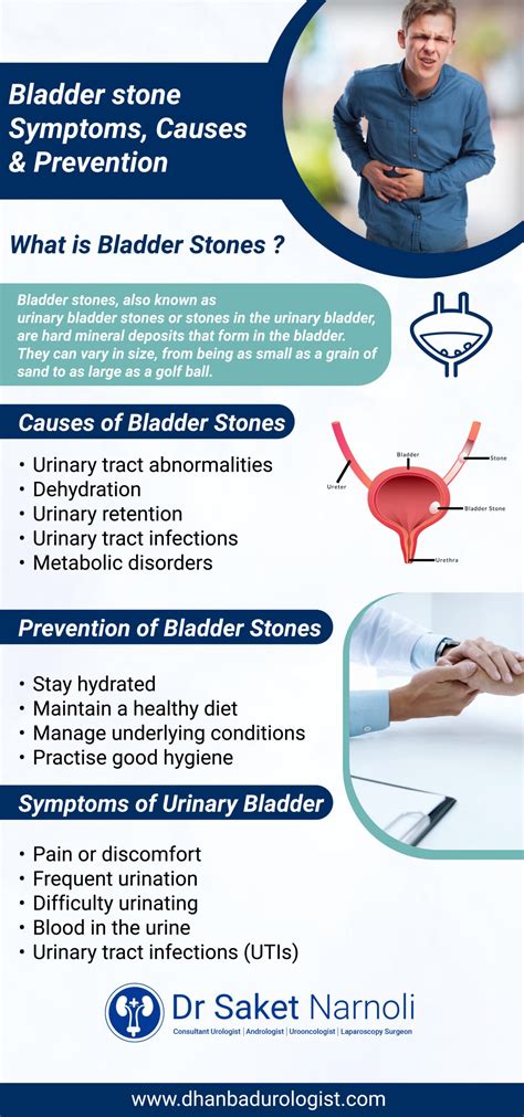 Bladder Stones: What You Need to Know About Symptoms & Causes