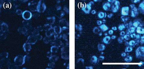 Second Harmonic Generation Microscopy: A Tool for Quantitative Analysis of Tissues | IntechOpen