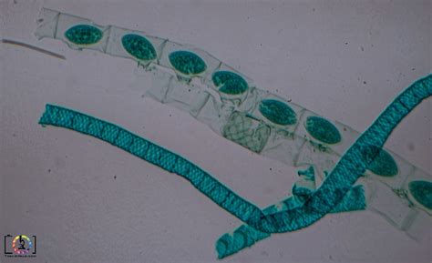 Under the Microscope: Spirogyra | Have a peek at Spirogyra u… | Flickr