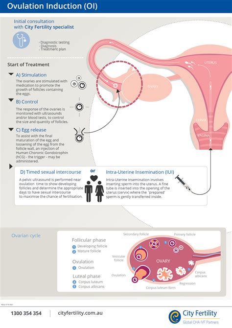 Ovulation Induction Fertility Treatment | City Fertility