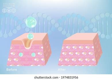 Hyaluronic Acid Before After Skin Solutions Stock Vector (Royalty Free) 1974831956 | Shutterstock