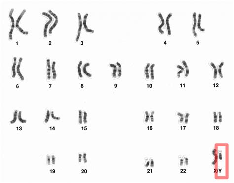 Y-DNA Test: What is a Y Chromosome Test and Which is Best