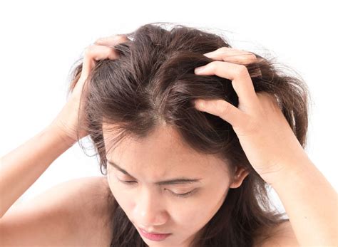 Simple Ways to Get Rid of That Dry Scalp | Salon Invi