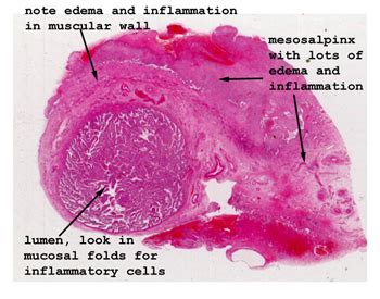 Slide 86_1