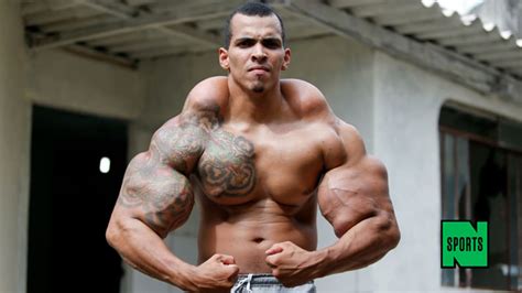 Brazilian Bodybuilder Nearly Has Arms Amputated After Turning Into Real ...