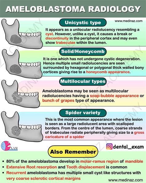 Dental Exam - Ameloblastoma Radiology