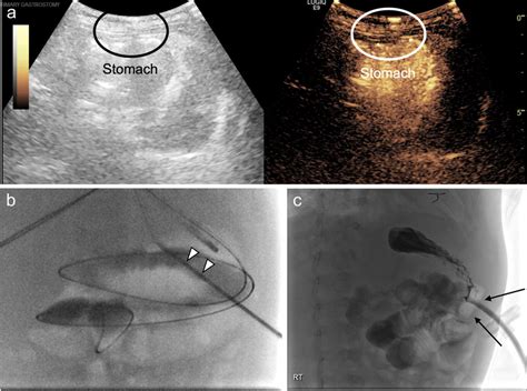 A 9-month-old boy with congenital heart disease. a Dual-screen mode ...