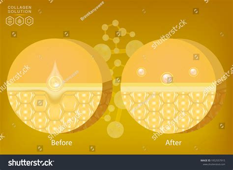 Hyaluronic Acid Before After Skin Solutions Stock Vector (Royalty Free) 1952557915 | Shutterstock