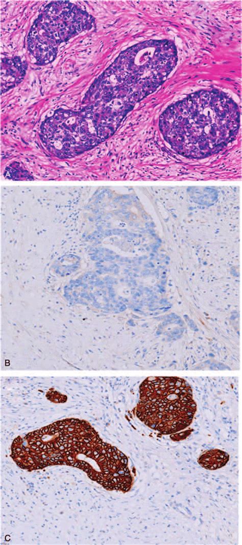 Histological findings of the tumor of the spleen. (A) Moderatelypoorly... | Download Scientific ...