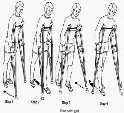 Four Point Gait Teaching ~ Nursing