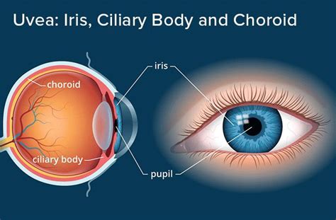 Iris and Uvea of the Eye - All About Vision