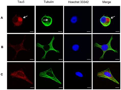 (A) Tau protein formed a spherical structure (arrow in the left panel ...