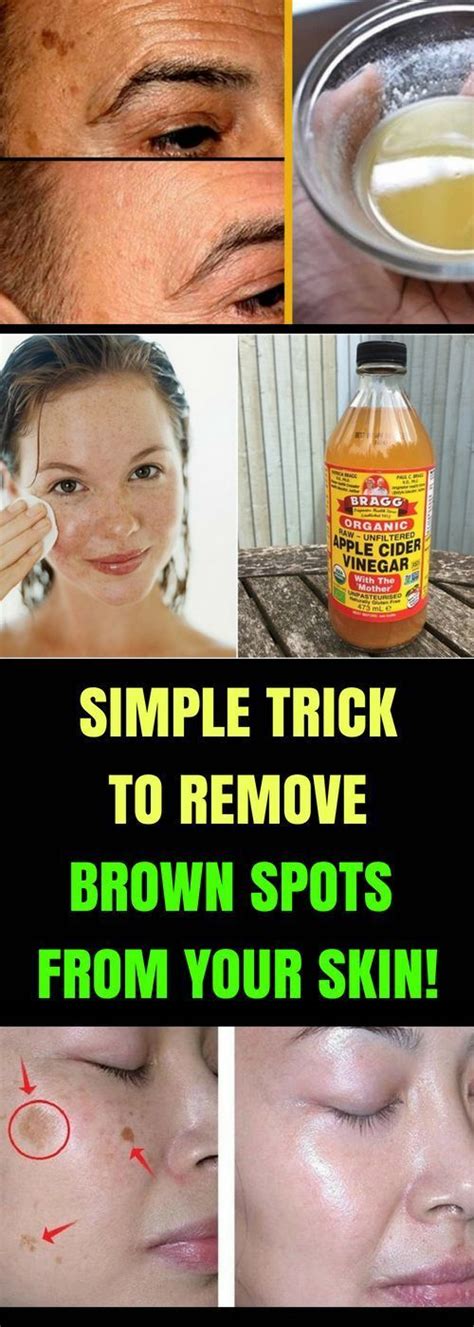 Let Start Slim Today: Simple Trick To Remove Brown Spots From Your Skin!!!