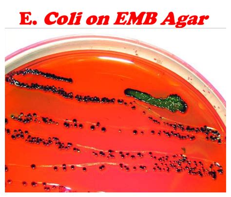 Eosin Methylene Blue (EMB) - SCIENTIST CINDY