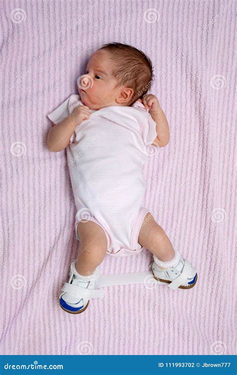 Newborn with Club Foot Wearing Orthopedic Shoes Stock Photo - Image of congenital, footwear ...