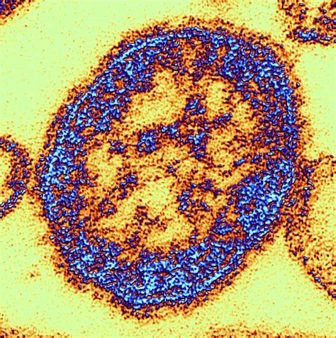 Measles Virus Particle Photograph by Alfred Pasieka - Pixels