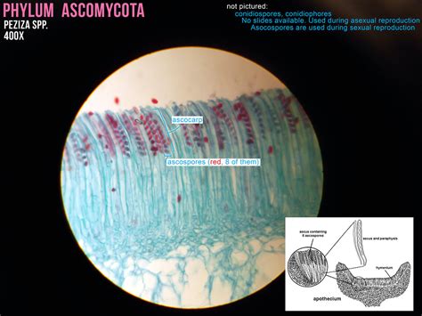 Peziza Under Microscope Labeled