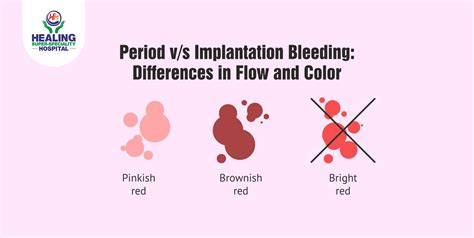 Period v/s Implantation Bleeding: Differences in Flow and Color