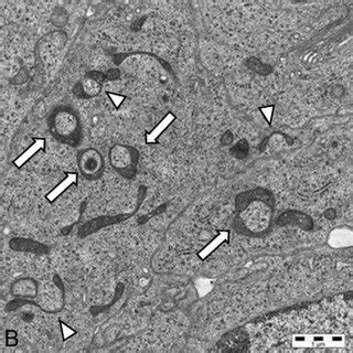 Representative figures captured by electron microscopy of mitochondrial... | Download Scientific ...