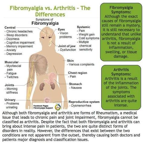 Compare arthritis and fibro!!!!! | Fibromyalgia causes, Arthritis, Fibromyalgia