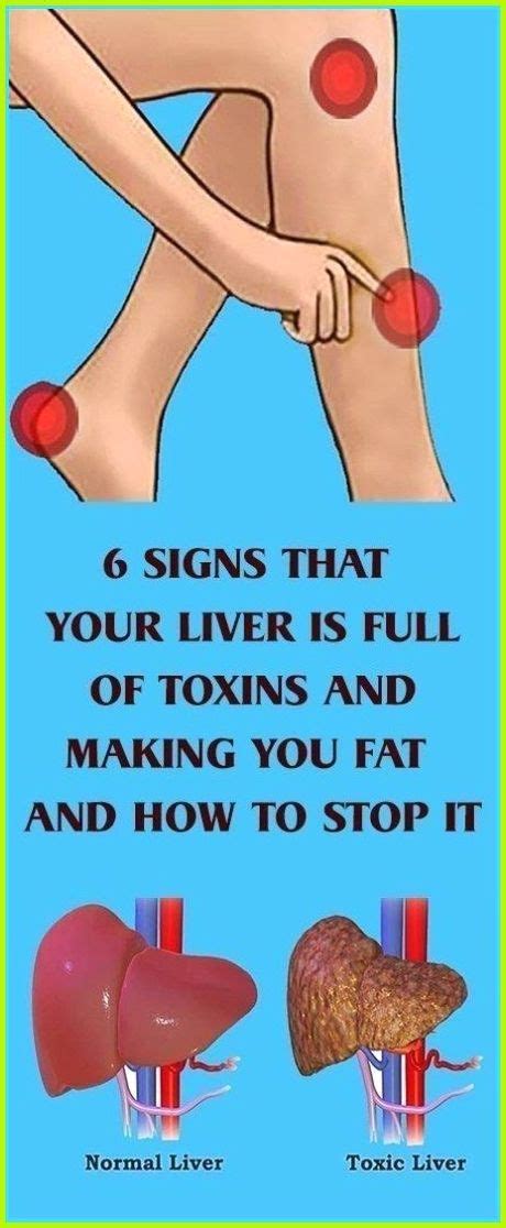 6 Signs That Your Liver is Full of Toxins - Healthy Beat in 2020 ...