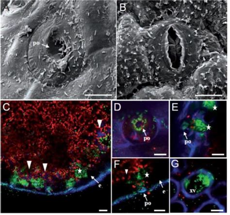 Immunity at hydathodes controls bacterial infection ($) | Plantae