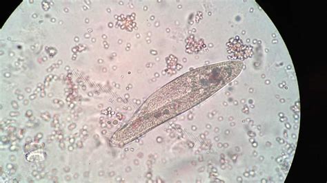 Paramecium Cell Under Microscope Labeled