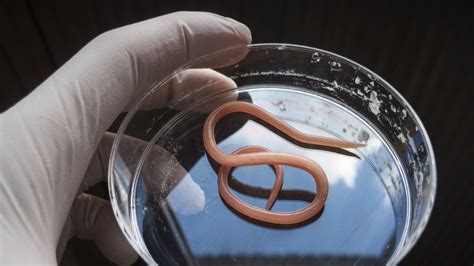 Roundworm Found In Human Gut Could Boost Fertility In Women, Study ...