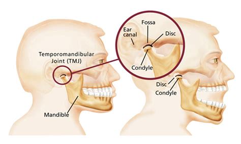 Jaw Pain Treatment Perth - Fortitude Chiropractic