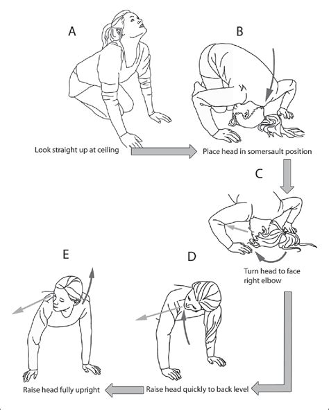 Home Epley Maneuver Diagram