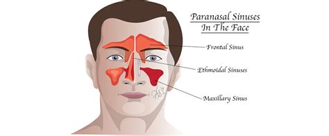 London ENT Associates | Blocked Nose