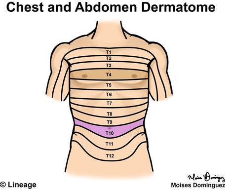 Dermatomes - Neurology - Medbullets Step 1