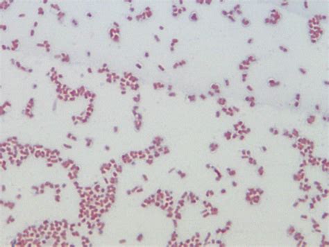 Enterobacter aerogenes gram stain I did this in school this week. The odd things on Pinterest ...