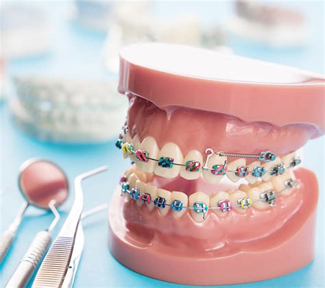 Early Orthodontic Treatment Is Beneficial - renewpurpose