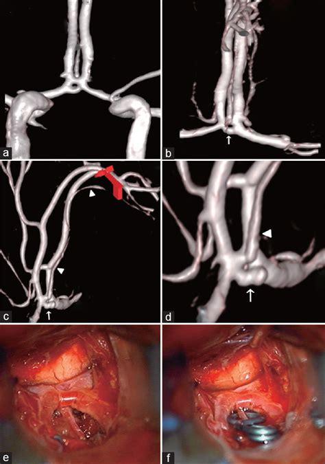 Surgical Neurology International