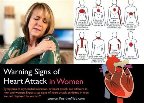 Warning signs of a heart attack in women | Signs of heart attack ...