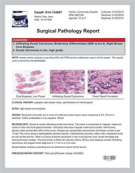 How to Read Your Pathology Report - Your Pathologist