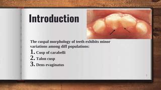 treatment of talon cusp in children | PPT