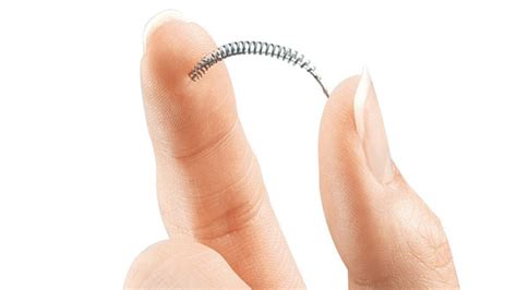 Essure birth control implant tied to greater need for 2nd surgical fix - Health - CBC News