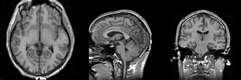 EMSegmenter-Tasks:MRI-Human-Brain - Slicer Wiki