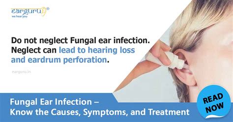 Causes, symptoms and treatment of fungal ear infection